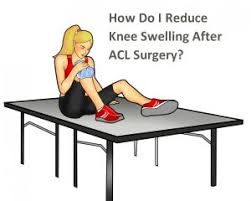 swelling after your acl surgery