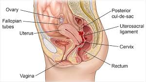 endometriosis signs and symptoms