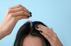 for seborrheic dermais hair loss
