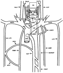 It is important to remember the position and orientation of the heart when placing a stethoscope on the chest of a patient and listening for heart sounds, and also when looking at images taken from a midsagittal perspective. Venous Chest Anatomy Clinical Implications Sciencedirect