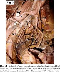 Check spelling or type a new query. Scielo Brasil Variability In The Origin Of The Obturator Artery Variability In The Origin Of The Obturator Artery