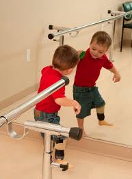 pediatric prosthetics information for