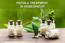 homeopathy cine for fistula