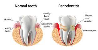 5 reasons to see a periodontist for