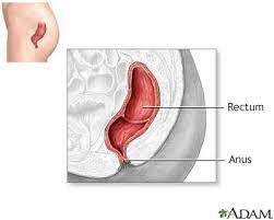 anorectal abscess information mount