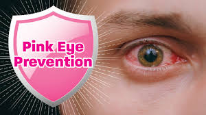 tips for pink eye prevention the