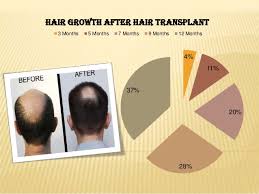 I would give it up to a few more months, but definitely follow up with your hair transplant surgeon. The Whole Story Of Hair Transplant