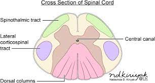 intramedullary spinal cord lesions