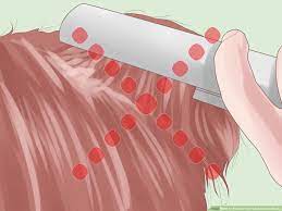 how to prevent hair loss due to stress