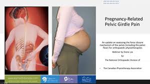 pregnancy pelvic girdle pain