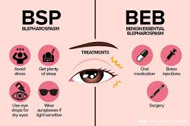 what is blepharospasm bsp