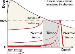 proton therapy for prostate cancer a