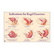 Indications For Kegel Exercises Chart Pelvic Floor