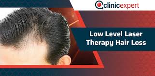 All other hairs are thus programmed to accelerate the birth of new, healthy hair follicles. Low Level Laser Therapy Hair Loss Clinicexpert International Healthcare