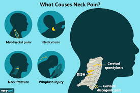 neck pain causes treatment and when