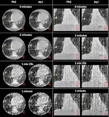 4d cone beam ct scans