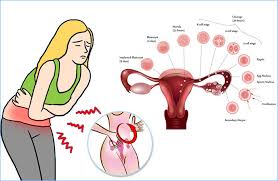 menstrual cr relief 5 natural ways