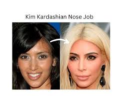 kim kardashian plastic surgery secrets