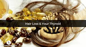 Thyroid conditions can cause hair loss if they are severe and go untreated. How To Overcome Hashimoto S Hair Loss Dr Izabella Wentz