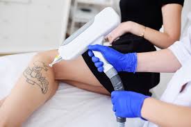 Choosing a microblade artist is not to be taken lightly. Tattoo Removal Destiny Direct