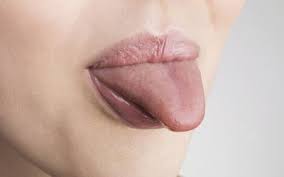 black tongue causes symptoms