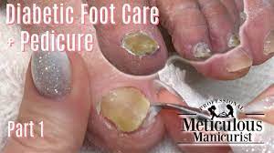diabetic foot care tips and pedicure