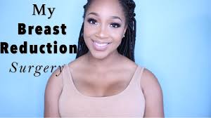 My Breast Reduction Surgery Part 1