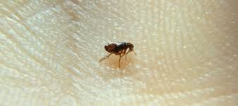 can fleas lay eggs on human hair abc
