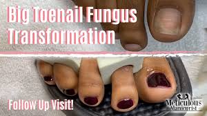 how to pedicure toenail fungus cleaning