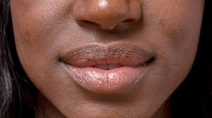 dry lips moisturized