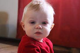 what causes redness around a baby s eyes