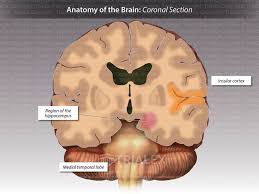 coronal section showing brain anatomy