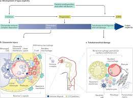 kidney in systemic lupus erythematosus