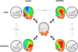 4 images 1 mot niveau 201. Eeg Changes Reflecting Pain Is Alpha Suppression Better Than Gamma Enhancement Sciencedirect