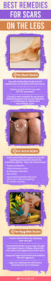 how to get rid of scars on the legs