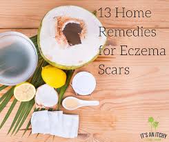 13 home remes for eczema scars