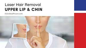 laser hair removal for the upper lip