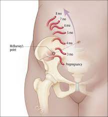 abdominal pain in early pregnancy psnet