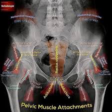 Pic source pelvic fractures 1024 x 1024 jpeg 352kb. Take A Look At This Annotated X Ray Which Exhibits You The Place A Number Of The Pelvic Musc Radiology Student Medical Anatomy Radiology