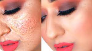 make pores disappear oily skin