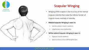 scar winging test orthoepdic