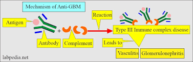 Anti Gbm Anti Anti Glomerular