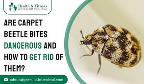 are carpet beetle bites dangerous and