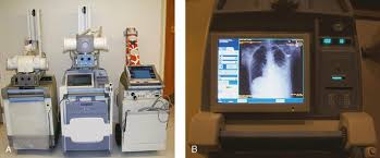 Mobile Radiography Radiology Key