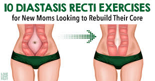 diastasis recti exercises for new moms