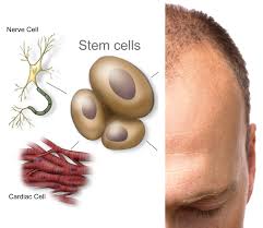 See the results for stem cell hair regrowth reviews in arlington Stem Cells To Create Hair Regrowth