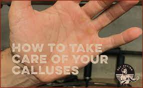 how to take care of your calluses the