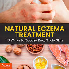 natural eczema treatment options dr axe