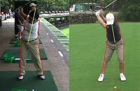 right sided swing the rss is an