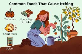 foods that cause itching common food